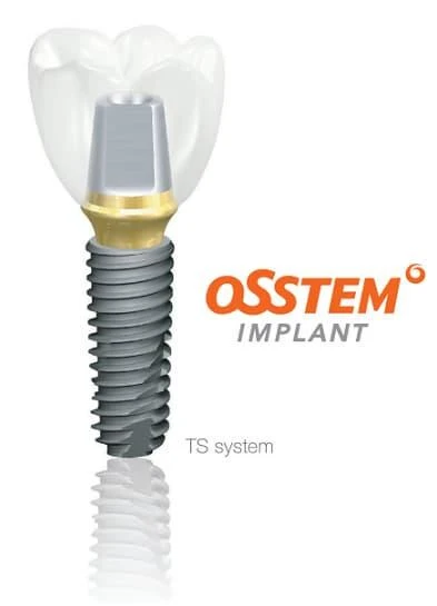 Implantát Osstem TS system s nadstavbou a korunkou